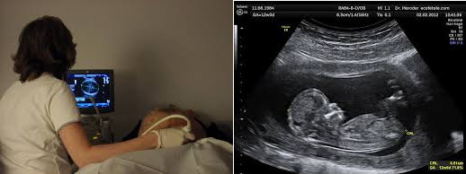 haciendo una ecografía